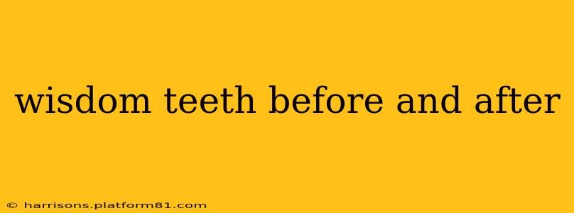 wisdom teeth before and after