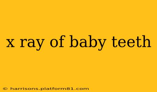 x ray of baby teeth